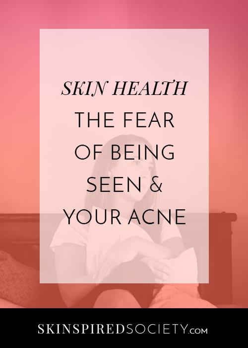 Fear of Being Seen and Acne